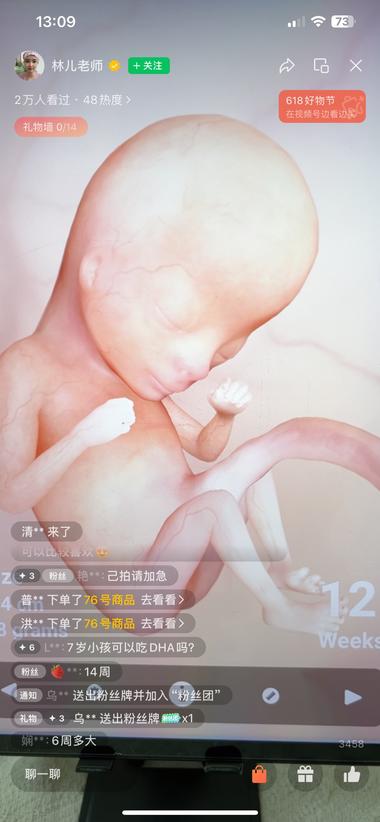 孕妈分享孕期的注意事项和营养搭配….-网创风向标论坛-网络创业-网创圈