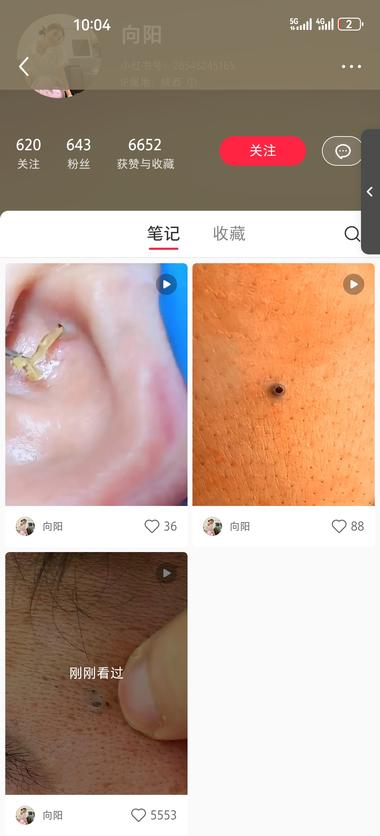 一个异常值，通过发布拔黑头痘痘的视频….-网创风向标论坛-网络创业-网创圈