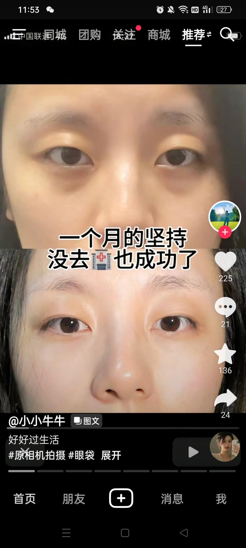 刷到一条很丝滑的引流单私域的方法，一张效果对比图，一条视频引导加入粉丝群，进群后有机器人间隔5秒左右发一条跳转链接-网创风向标论坛-网络创业-网创圈