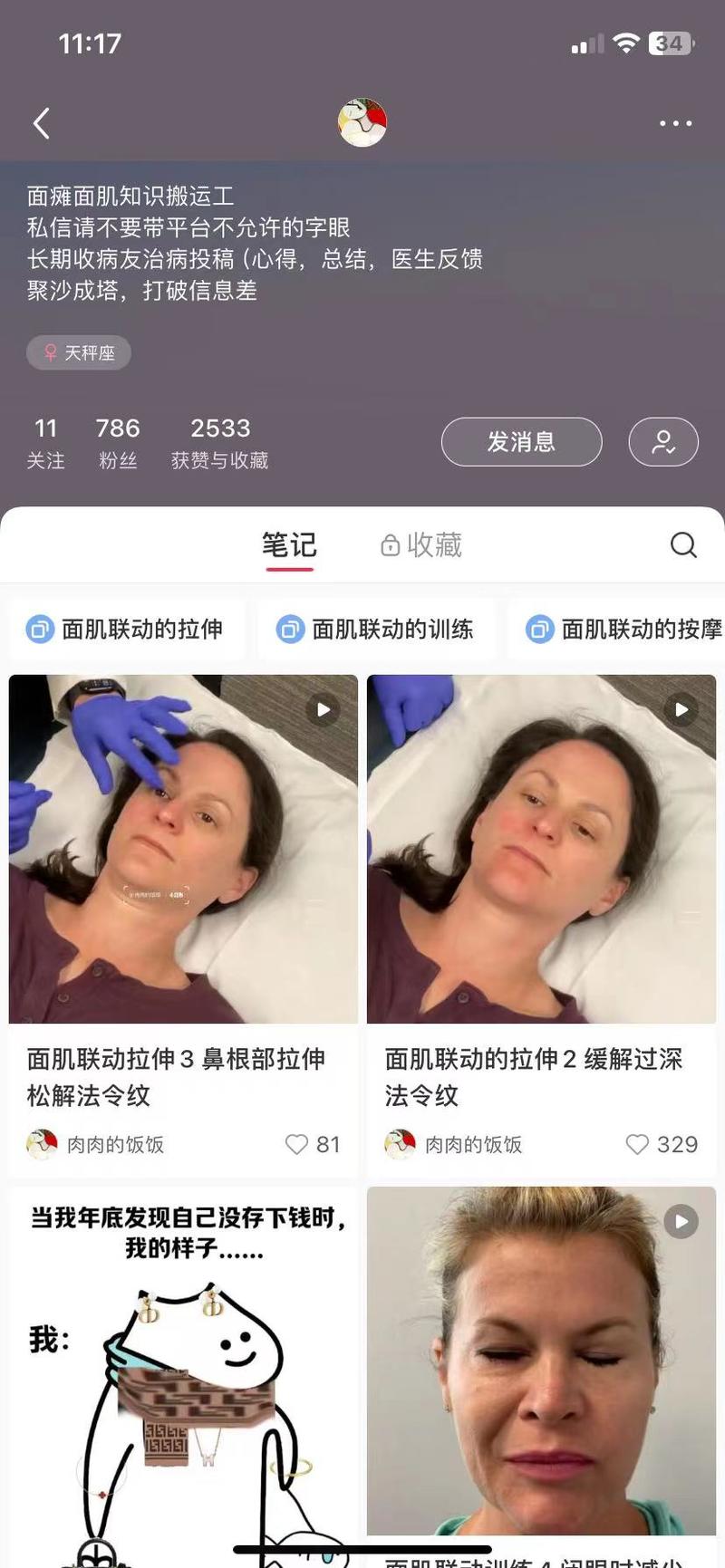 这个博主从youtube搬运关于面瘫的恢复手法，也拉了一个群，群里基本都是相关患者，互相交流疑难杂症；1个月涨了700粉，都是精准粉丝；如果有做这方面的疗法，同时效果好，而且地域比较近，可以尝试这样做引流；其实很多人是愿意试试的；毕竟疑难杂症很折磨人的心态；本人也是面肌痉挛患者，会跟着按按，如果有圈友有治疗好的经验跪求告诉一下呀！-网创风向标论坛-网络创业-网创圈