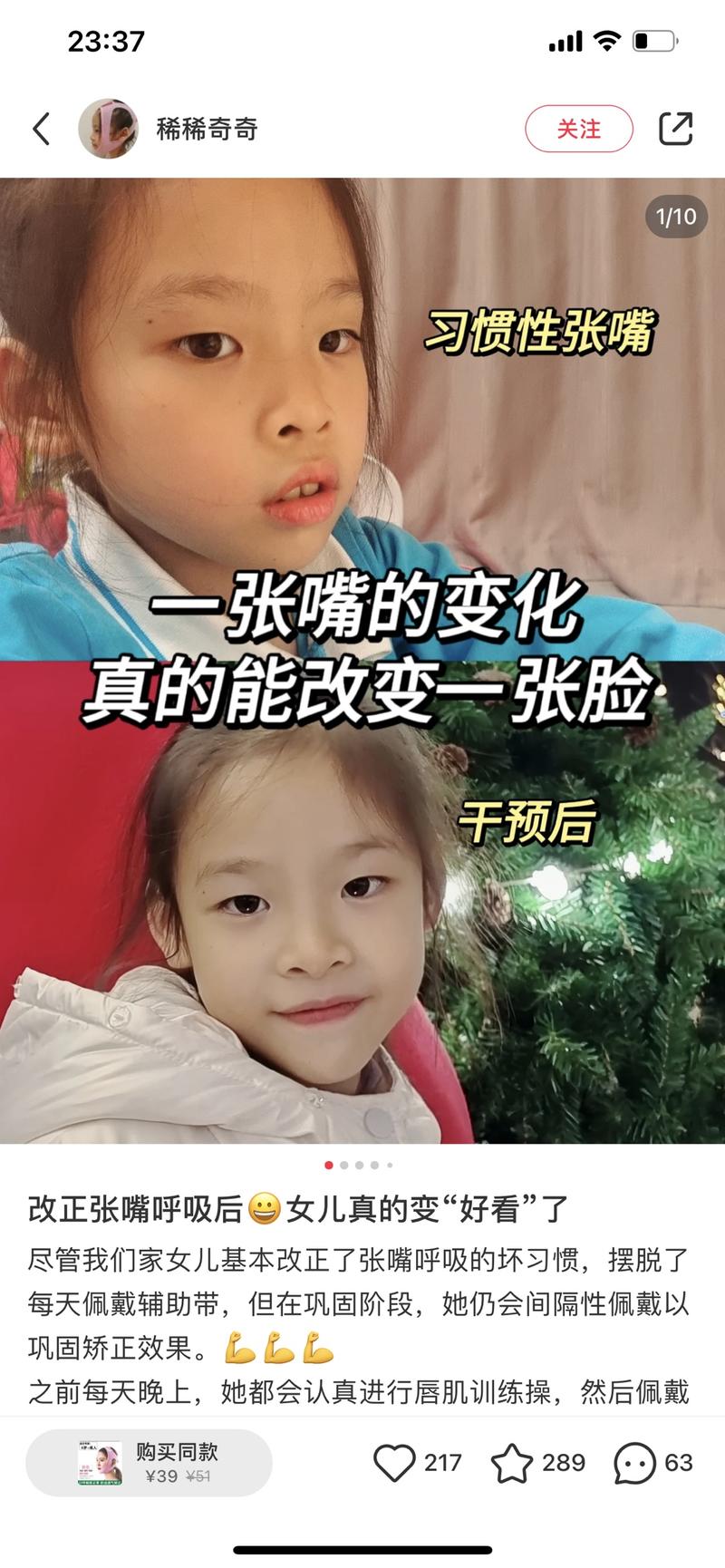 口呼吸矫正器，用户定位儿童….-网创风向标论坛-网络创业-网创圈