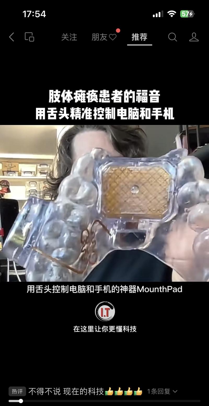 残疾人辅助工具MouthPad￼视频展示了一款放入口中用舌头操作的工具，可以帮助肢体瘫痪者，用舌头灵活控制手机电脑等外设。1.让人一下体会到科技发展的意义。2.很震撼，容易引起人们点赞和转发。-网创风向标论坛-网络创业-网创圈